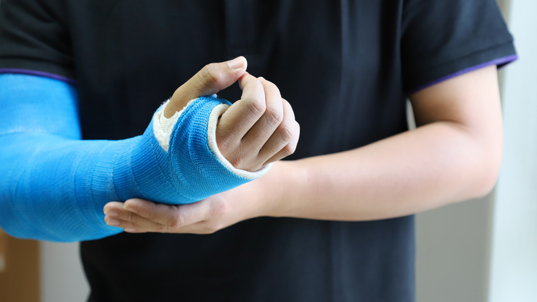 Person with arm in cast